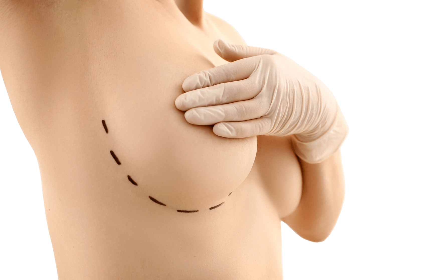 Пластика тела