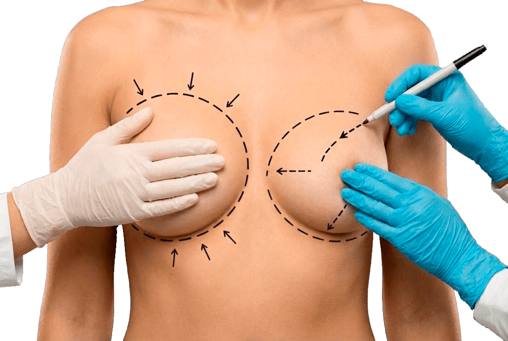 Коррекция асимметрии груди